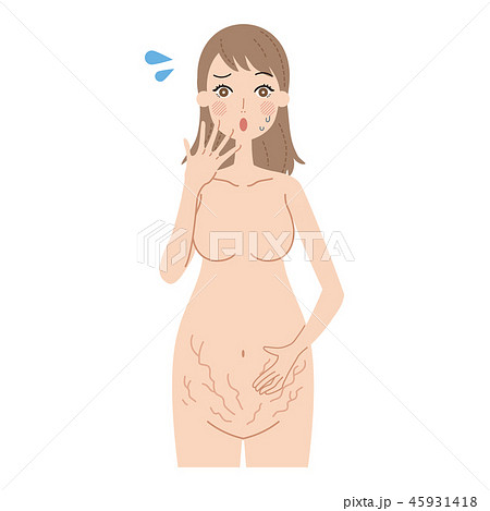 妊娠線にショックを受ける妊婦。 妊娠線にショックを受ける妊婦。 45931418