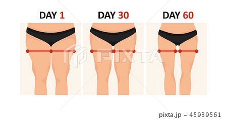 Thick legs and thin legs - Stock 