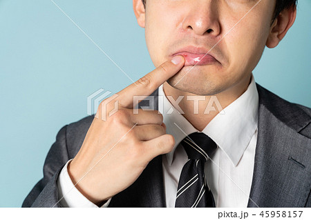 口内炎の男性 45958157