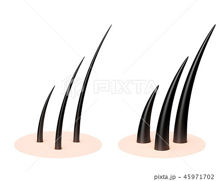 毛 髪の毛 パターン 毛 髪の毛 パターン 45971702