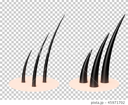 毛 髪の毛 パターン 毛 髪の毛 パターン 45971702