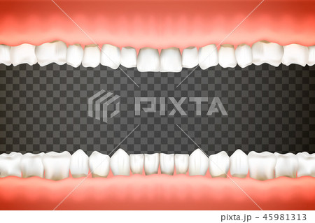 Human Teeth Open Mouth
