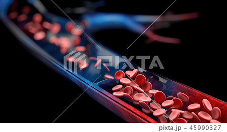 Varicose veins close up. Human legs 45990327