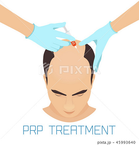 PRP treatment for men PRP treatment for men 45993640