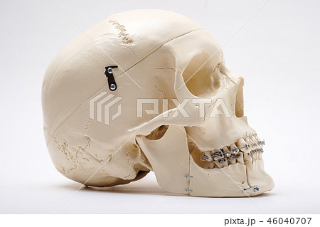 otthodontic braces bracket wire 46040707