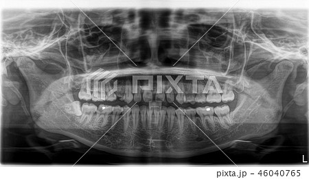 X-ray film Head and mouth X-ray film Head and mouth 46040765