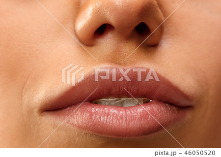 Beautiful young woman with teeth braces Beautiful young woman with teeth braces 46050520