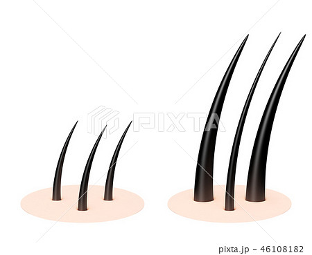 毛 髪の毛 パターン 毛 髪の毛 パターン 46108182