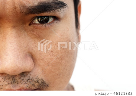 asian man face skin after not get a wink of sleep 46121332