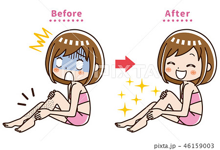 足　脱毛　ビフォー　アフター 46159003