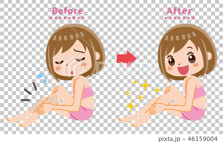 足　脱毛　ビフォー　アフター 46159004