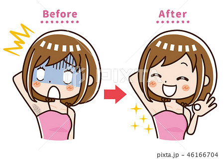 脇　脱毛　ビフォー　アフター 46166704