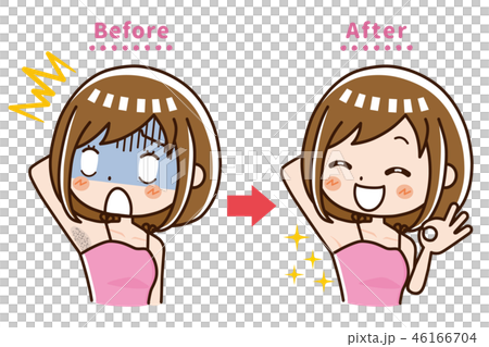脇　脱毛　ビフォー　アフター 46166704