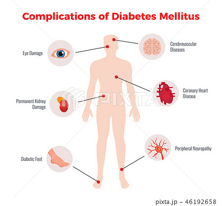 Diabetes Medical Poster  46192658