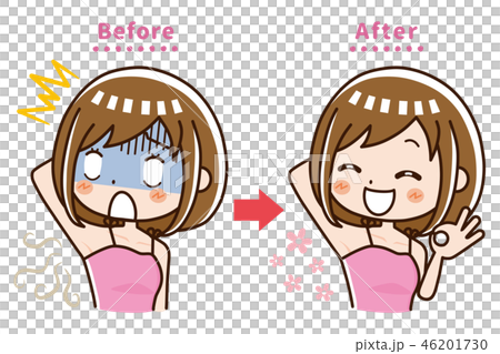 脇　臭い　ビフォーアフター 46201730