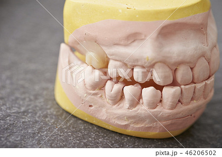 歯型模型 46206502