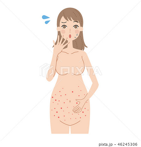 発疹がでた妊婦 46245306