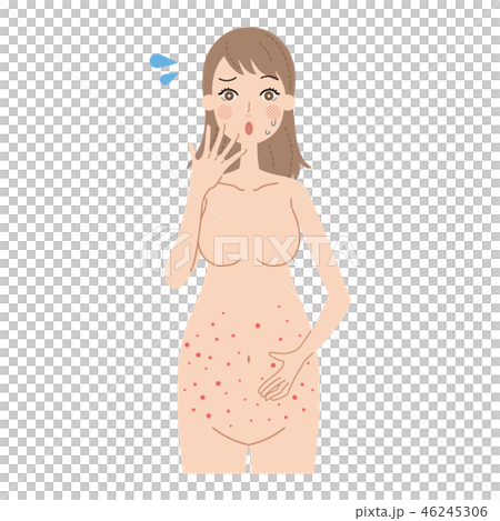 発疹がでた妊婦 46245306
