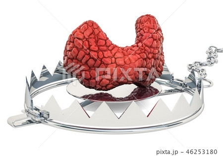 Thyroid disease concept. Human thyroid inside trap 46253180