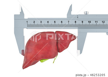Human liver with vernier caliper Human liver with vernier caliper 46253205