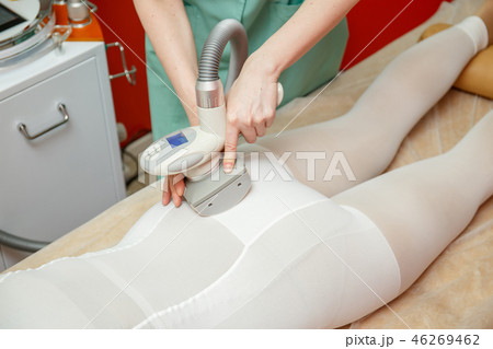 Woman having anti cellulite lpg massage Woman having anti cellulite lpg massage 46269462