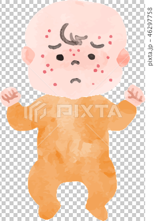 発疹ができた赤ちゃん 発疹ができた赤ちゃん 46297758