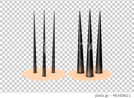 Scalp hair zoom Scalp hair zoom 46300621