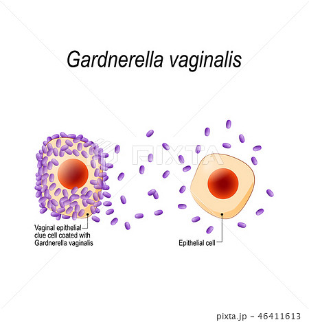 Gardnerella vaginalis Gardnerella vaginalis 46411613
