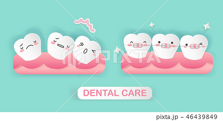 tooth with brace concept 46439849