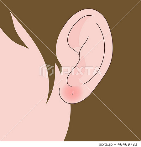 ピアス　耳　化膿　腫れる 46469733