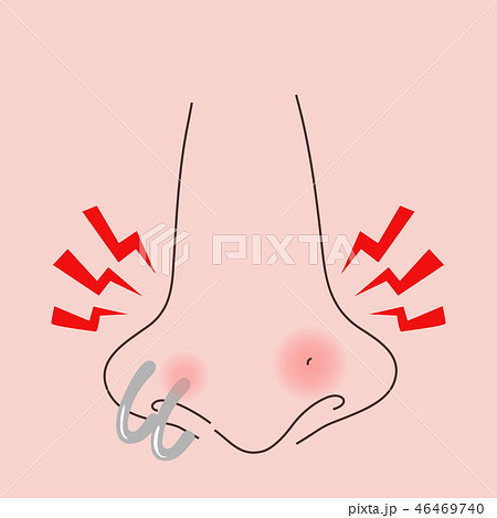 ピアス 鼻 化膿 腫れるのイラスト素材