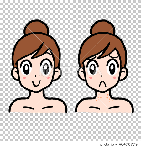 女性 顔 ノーマルと首プツプツ 46470779