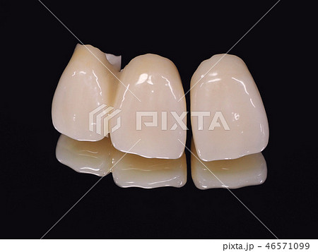 CAD/CAMオールセラミックス　-歯科技工- 46571099