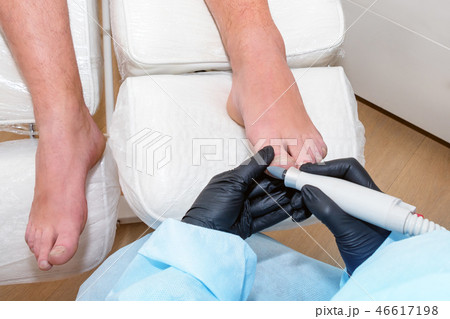 Podology treatment. Podiatrist treats foot. Podiatry doctor or dermatologist treats the patient in 46617198