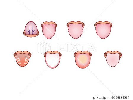 舌に現れる健康状態のイラスト素材