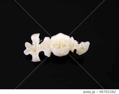 ハイブリッドセラミックスインレーブリッジ ハイブリッドセラミックスインレーブリッジ 46702382