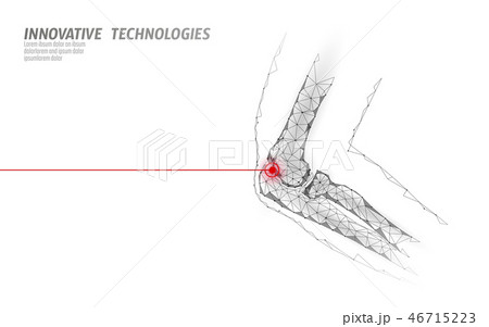 Human elbow joint 3d model vector illustration. Low poly design future technology cure pain 46715223