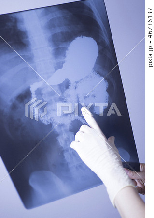 Medical xray spine hip scan 46736137