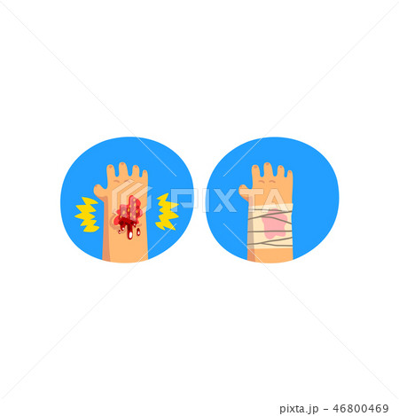 Wounded hand, physical injury, first aid and treatment vector Illustration on a white background 46800469