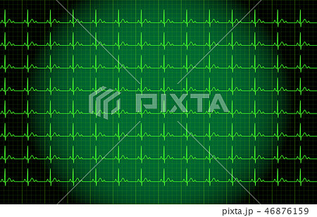 心電図　イメージ 46876159