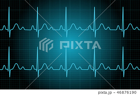 心電図　イメージ 46876190