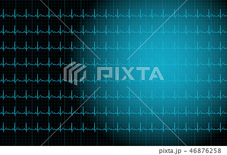 心電図 イメージ 心電図 イメージ 46876258