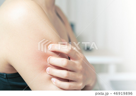 Women hand scratch the itch on arm, healthcare Women hand scratch the itch on arm, healthcare 46919896