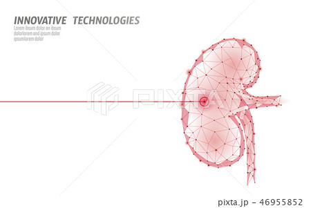 Human kidneys laser surgery operation low poly. Medicine disease drug treatment painful area. Red 46955852