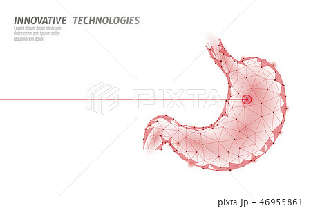 Human stomach laser surgery operation low poly. Medicine disease drug treatment painful area. Red 46955861