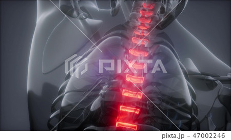 Hurt Spine. Male Backbone. Backache Hurt Spine. Male Backbone. Backache 47002246
