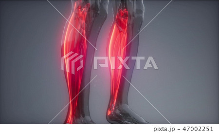 gastrocnemius- Visible muscle anatomy map 47002251