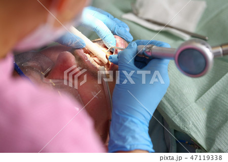 Female hand in blue protective gloves Female hand in blue protective gloves 47119338