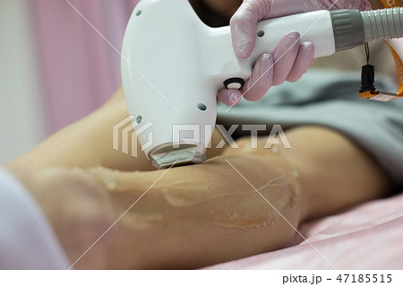 Laser epilation and cosmetology. Laser hair removal cosmetology procedure. 47185515