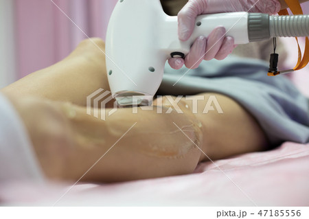 Laser epilation and cosmetology. Laser hair removal cosmetology procedure. Laser epilation and cosmetology. Laser hair removal cosmetology procedure. 47185556